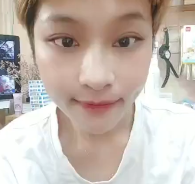 自体脂肪胶