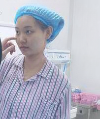 自体脂肪胶