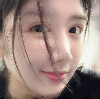 自体脂肪胶