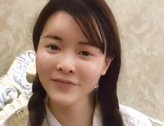 自体脂肪胶