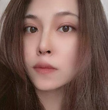 自体脂肪胶