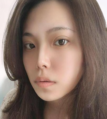 自体脂肪胶