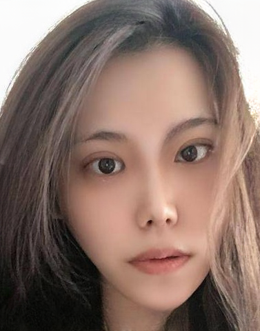 自体脂肪胶