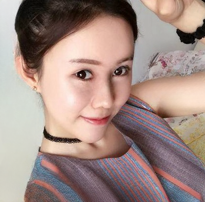 自体脂肪胶
