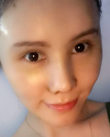 自体脂肪胶
