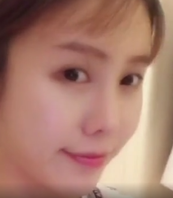 自体脂肪胶