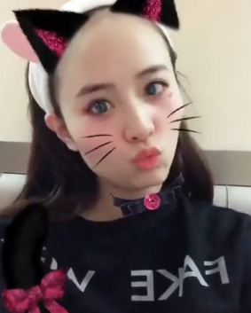 自体脂肪胶