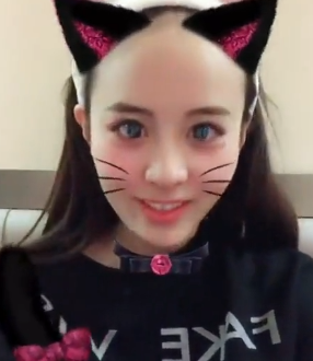 自体脂肪胶