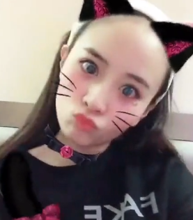自体脂肪胶