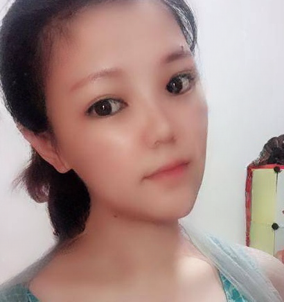 自体脂肪胶