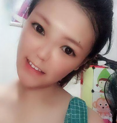 自体脂肪胶