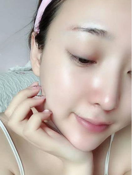 自体脂肪胶