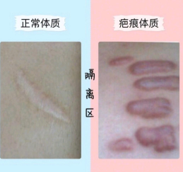 眼袋