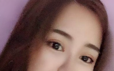 双眼皮手术