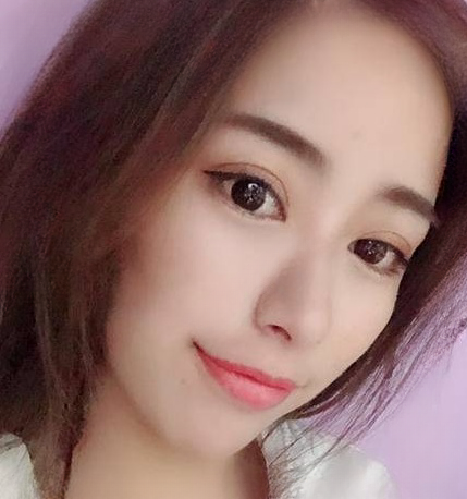 双眼皮手术