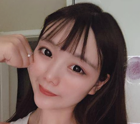 自体脂肪胶