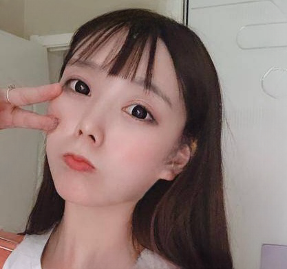 自体脂肪胶