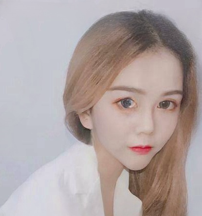自体脂肪胶