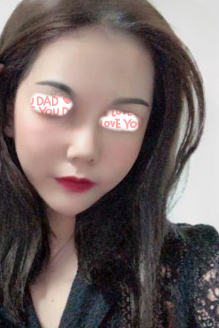 自体脂肪胶