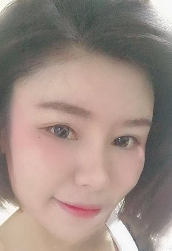 自体脂肪胶