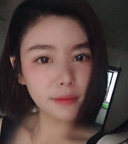自体脂肪胶