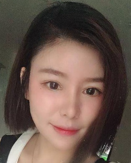 自体脂肪胶