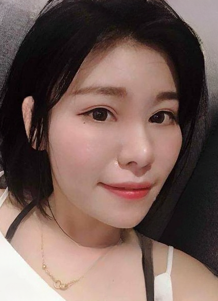 自体脂肪胶