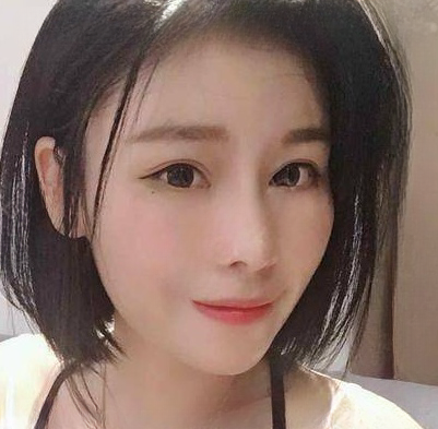 自体脂肪胶