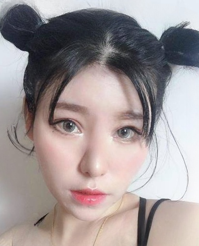自体脂肪胶