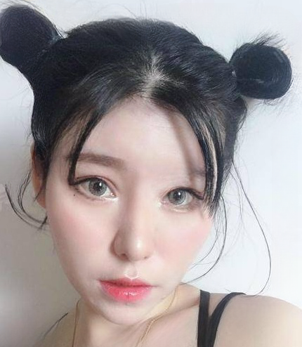 自体脂肪胶