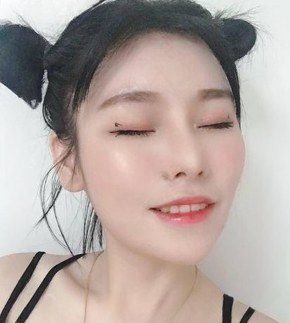 自体脂肪胶