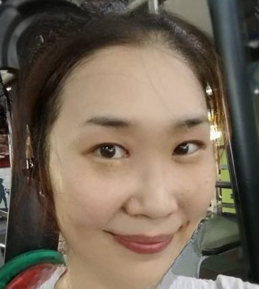 去眼袋手术