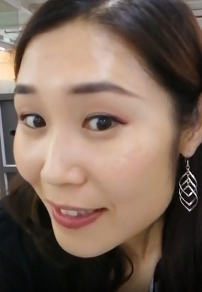 去眼袋手术