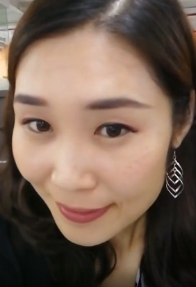 去眼袋手术