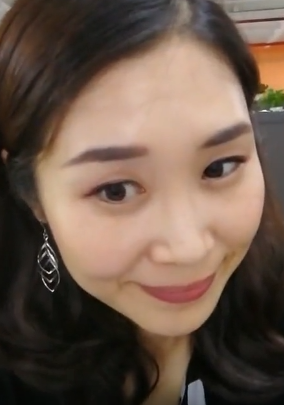 去眼袋手术