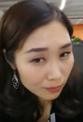 去眼袋手术