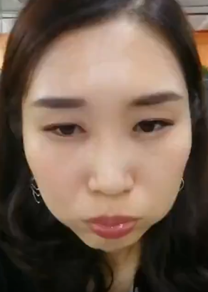 去眼袋手术