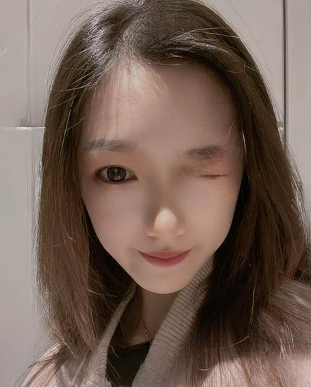 自体脂肪胶