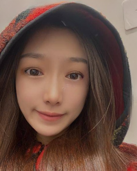 自体脂肪胶