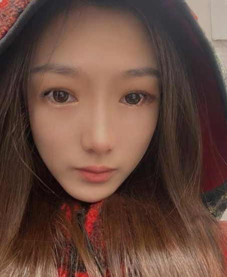 自体脂肪胶