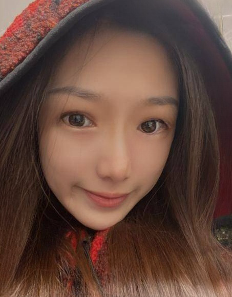 自体脂肪胶