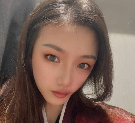 自体脂肪胶