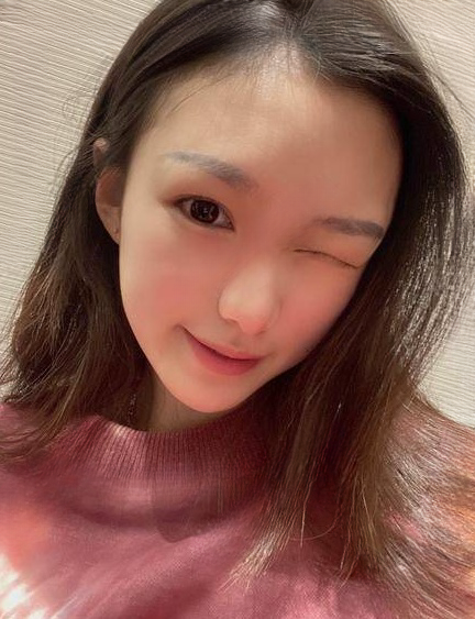 自体脂肪胶