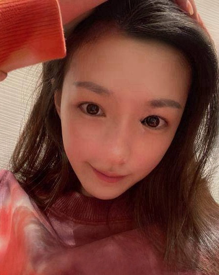 自体脂肪胶