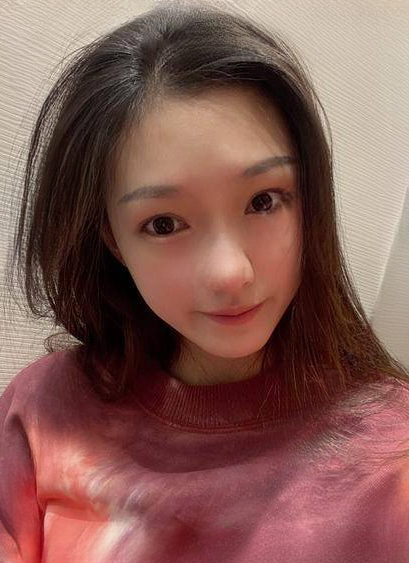 自体脂肪胶