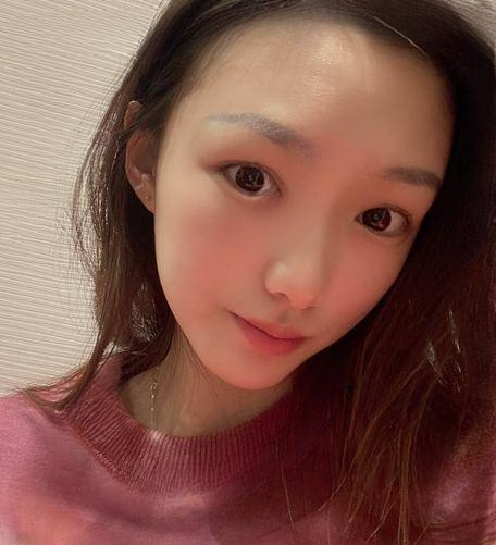 自体脂肪胶