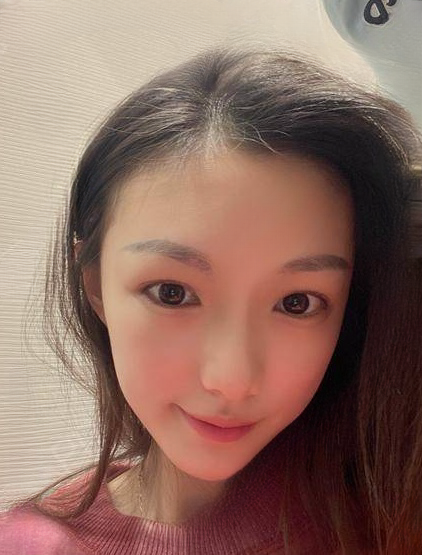 自体脂肪胶