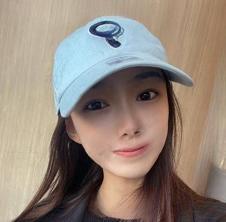 自体脂肪胶
