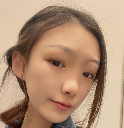 自体脂肪胶