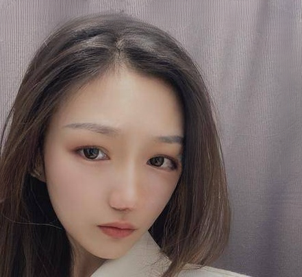 自体脂肪胶